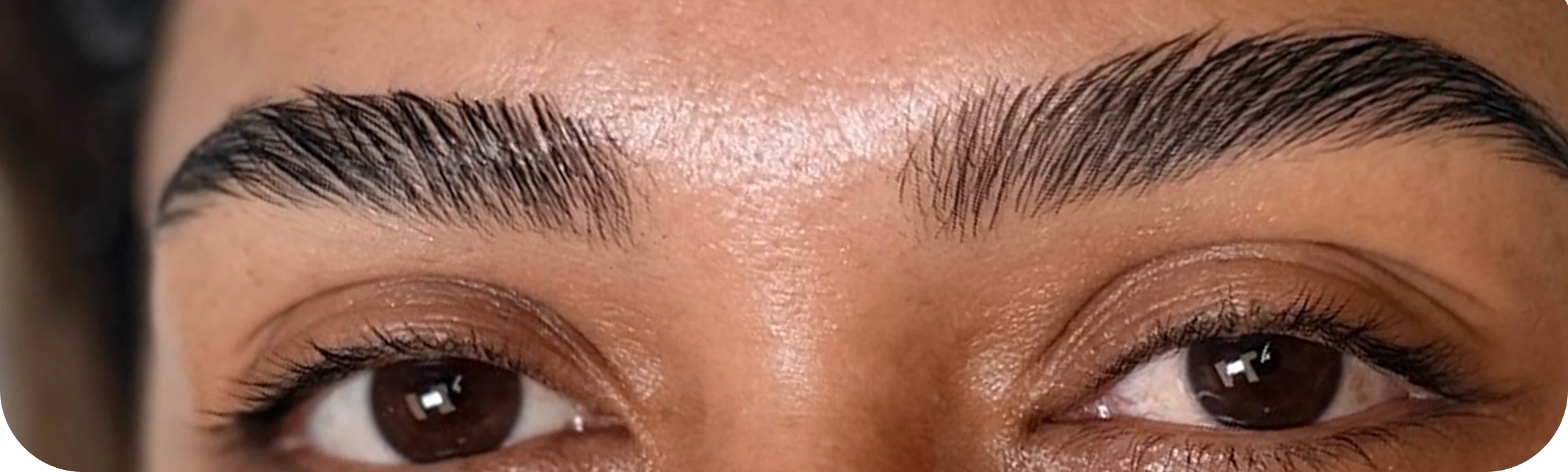 Cejas, caso 1: después del tratamiento.