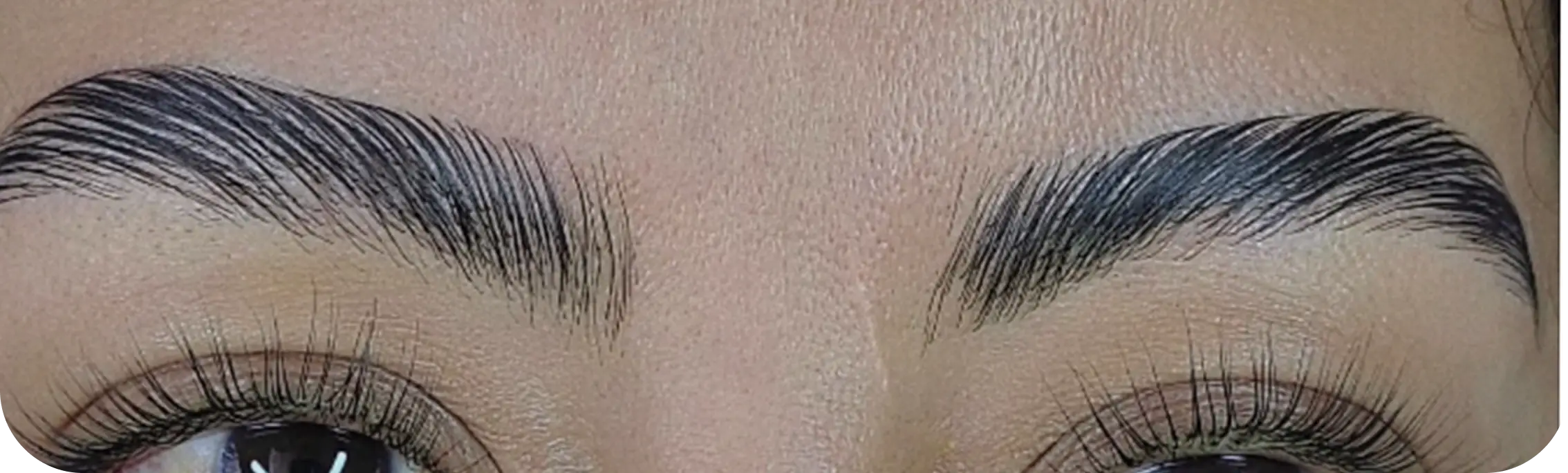 Cejas, caso 2: después del tratamiento.
